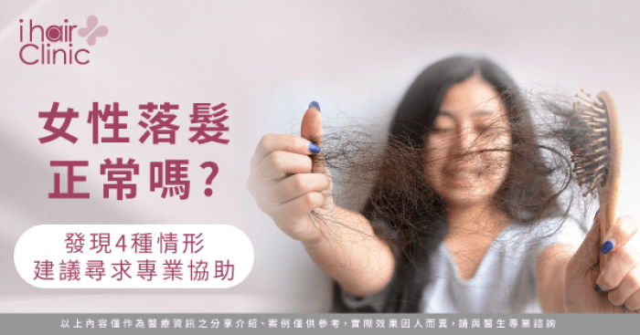 女性落髮原因-新竹植髮推薦