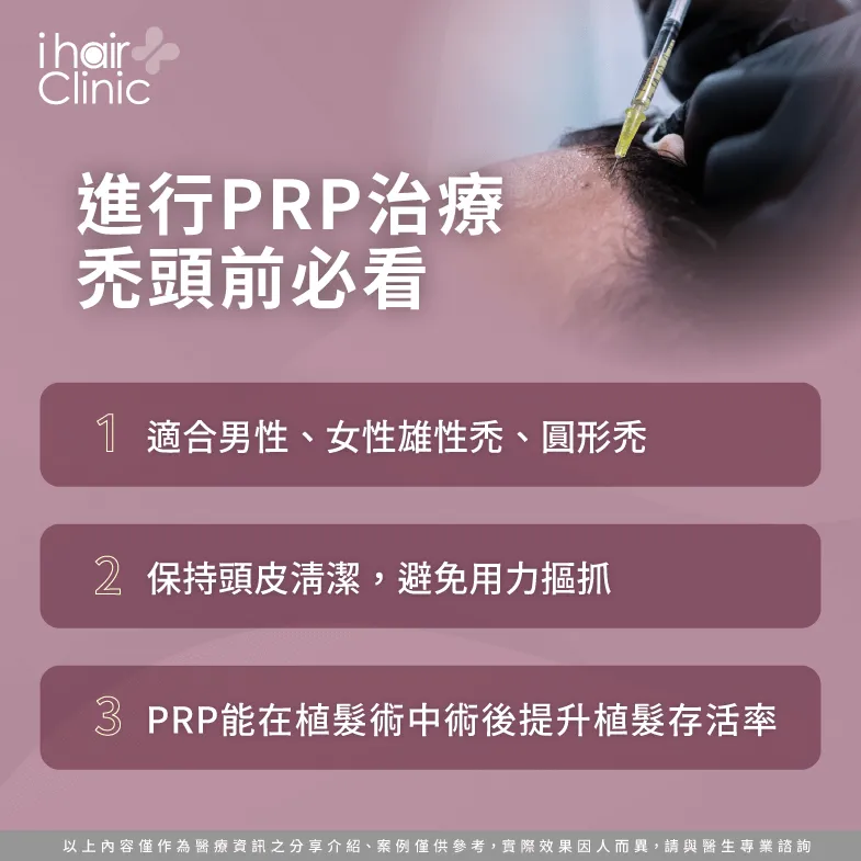 prp治療禿頭前必看-掉髮 PRP