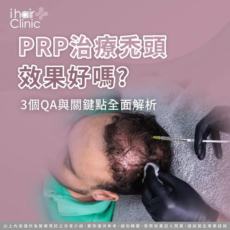 prp治療禿頭-掉髮 prp