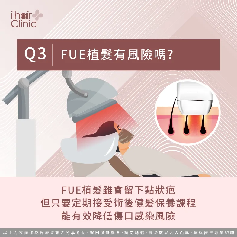 fue微創植髮傷口感染風險低-fue微創植髮