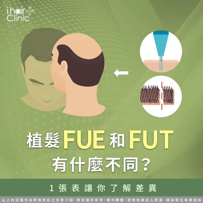 植髮fue和fut-fut fue